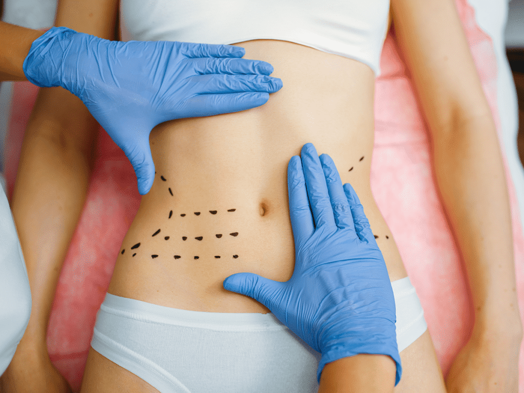 cirugia plastica estetica mdh